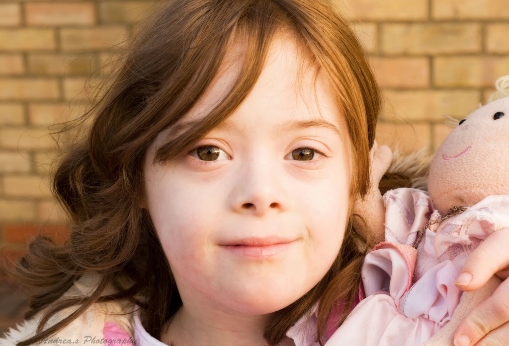 Zespół downa – najczęściej diagnozowana trisomia